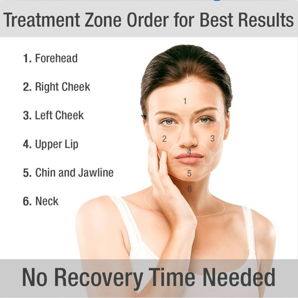 Silk'n Titan Anti Aging Skin Tightening Device - Picture 3 of 7